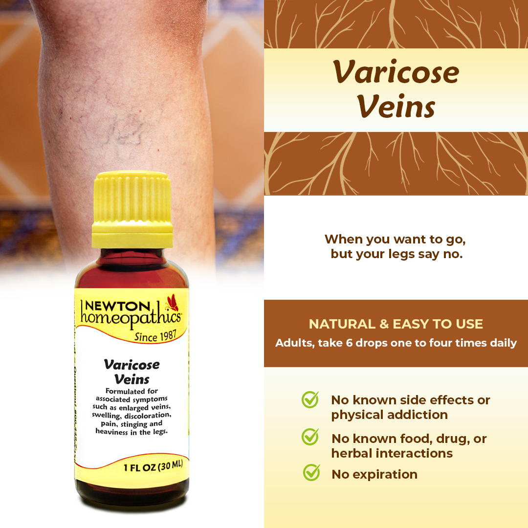 VARICOSE VEINS
