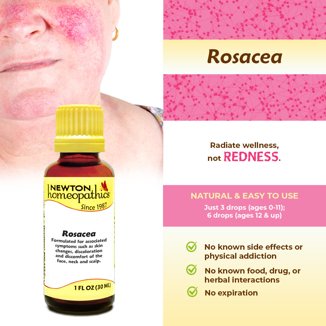 ROSACEA