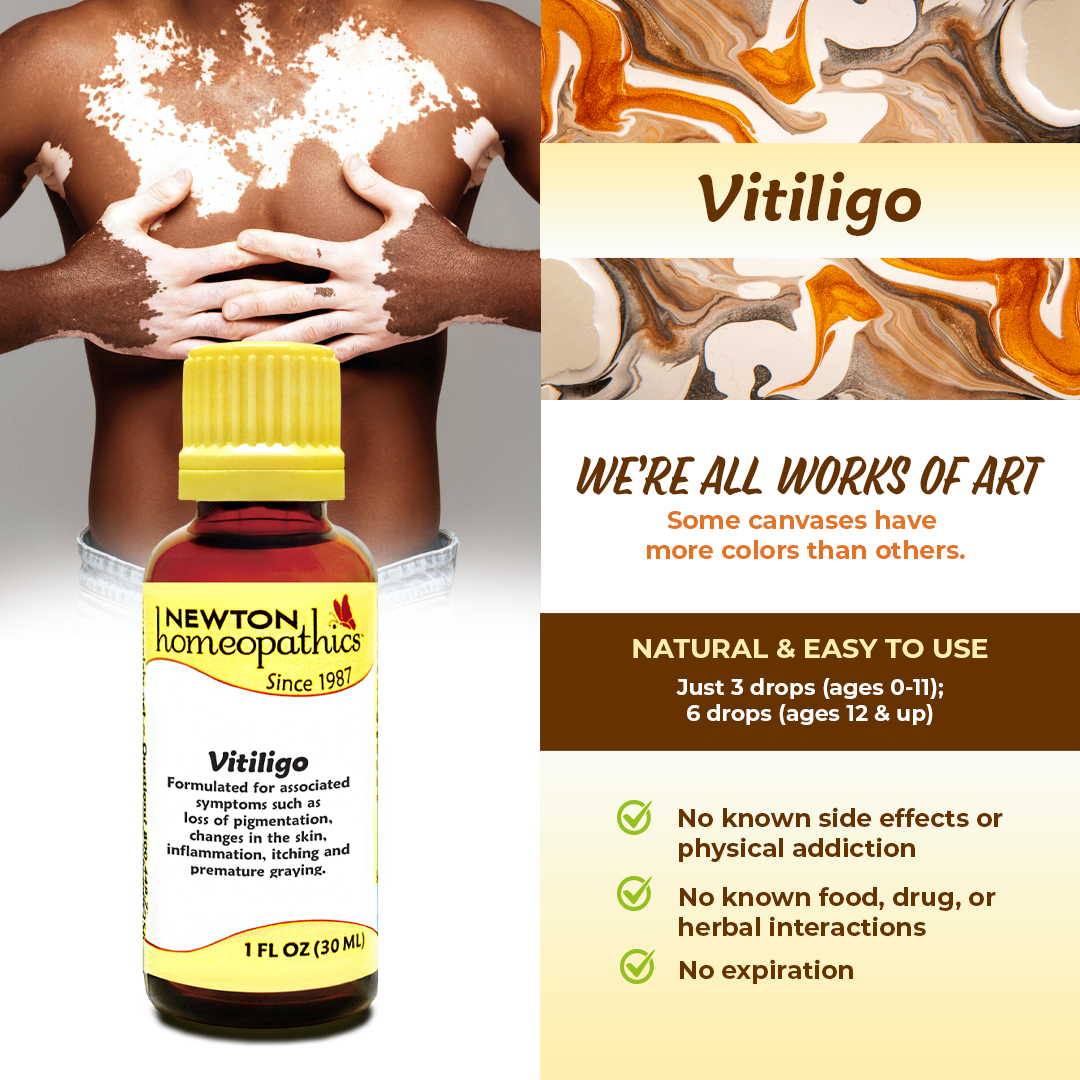 VITILIGO (1 oz)