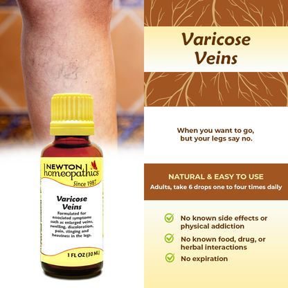 VARICOSE VEINS