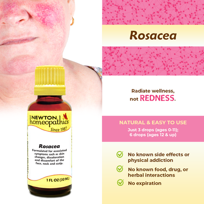 ROSACEA