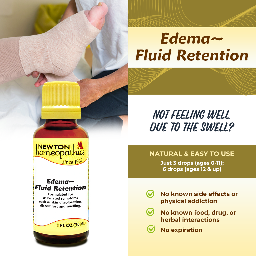 EDEMA ~ FLUID RETENTION