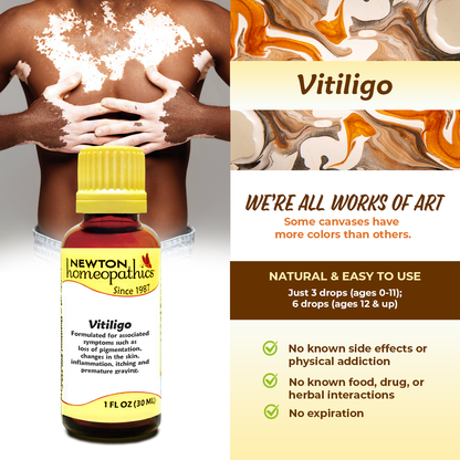 VITILIGO (1 oz)